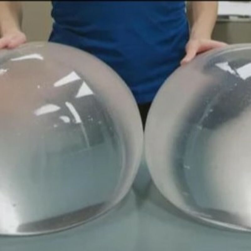 GIANT F$@*ING IMPLANTS!!!